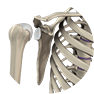 Shoulder Instability Procedure