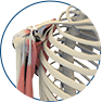 Complex, Reconstructive Shoulder Surgery