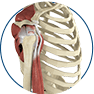 Rotator Cuff Repair